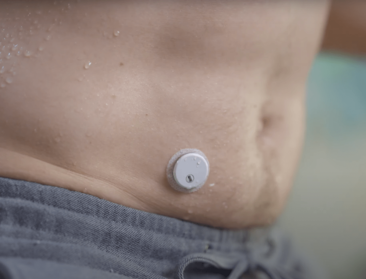 Aidex X folyamatos vércukormérő szenzor CGM a világ legkisebb érzékelője - LCDEAL